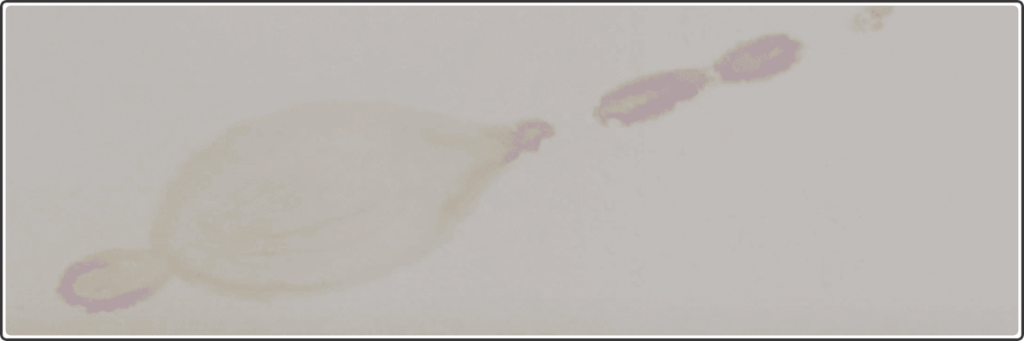 Damp ceiling patches caused by terrace crack leakage